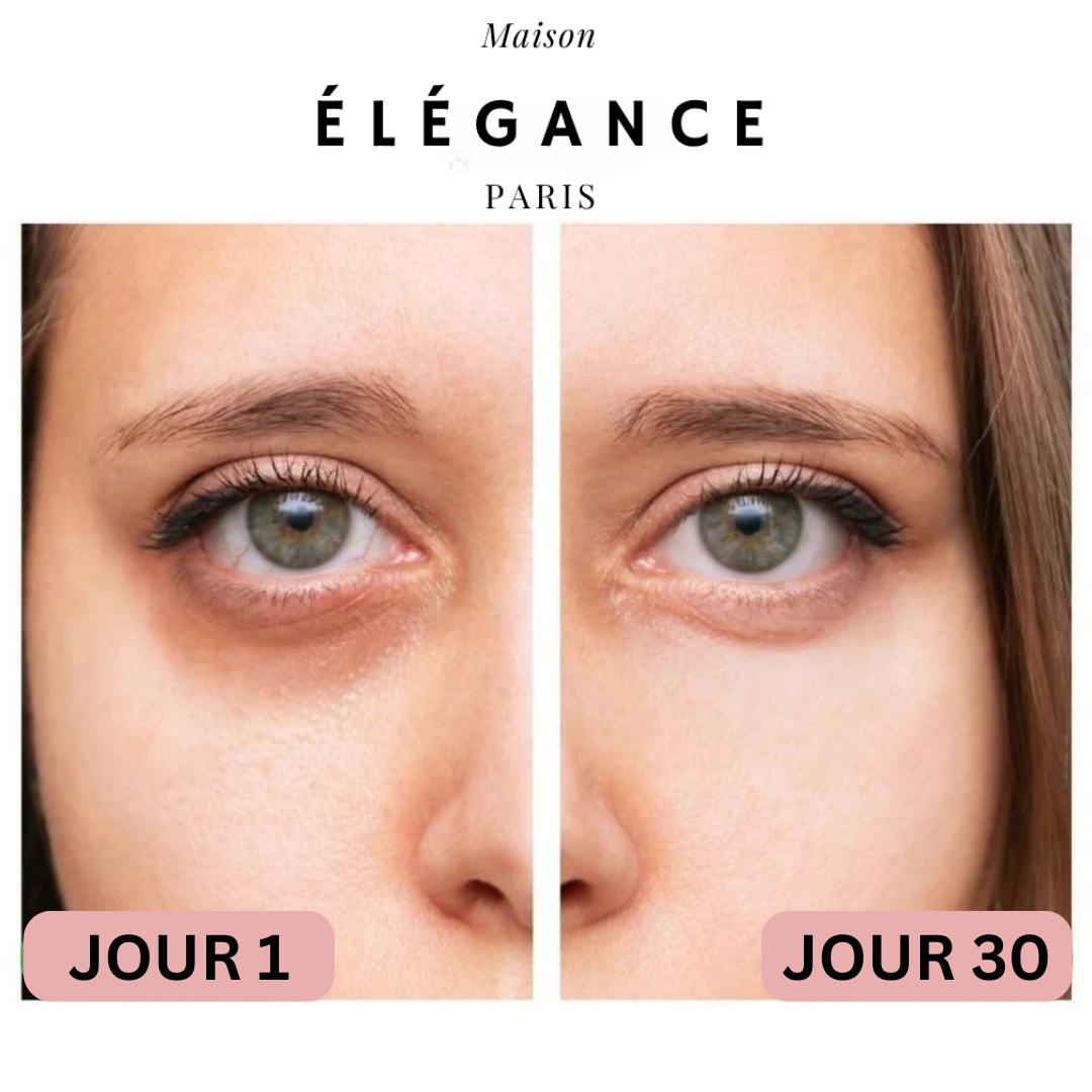 3D EyeBeauty™ Thérapie par la lumière rouge sous les yeux